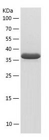    AGPHD1 / Recombinant Human AGPHD1