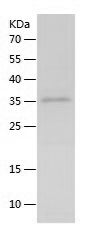 Recombinant Rat IL-21