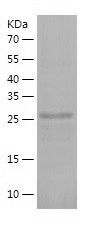    PITPNM2 / Recombinant Human PITPNM2