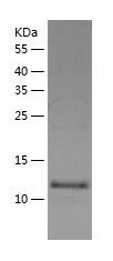    FABP12 / Recombinant Human FABP12