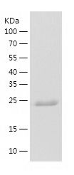    PTGES2 / Recombinant Human PTGES2