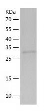    CCDC69 / Recombinant Human CCDC69