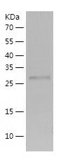    UNC119B / Recombinant Human UNC119B