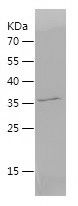    Galectin 10 / Recombinant Human Galectin 10