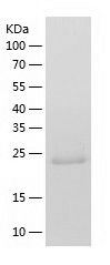    Thymidine Kinase 2 / Recombinant Human Thymidine Kinase 2