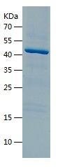    ACOT7 / Recombinant Human ACOT7