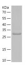    HAX1 / Recombinant Human HAX1