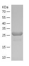    EYA2 / Recombinant Human EYA2