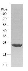    RAB27B / Recombinant Human RAB27B