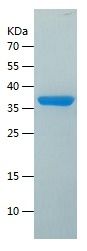    SULT2B1 / Recombinant Human SULT2B1