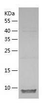    AGRP / Recombinant Human AGRP