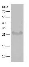    TULP1 / Recombinant Human TULP1