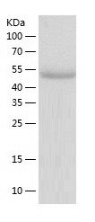    TULP2 / Recombinant Human TULP2