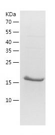    Osteoprotegerin / Recombinant Human Osteoprotegerin