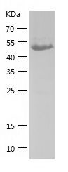    PDHX / Recombinant Human PDHX