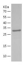    SULT1C2 / Recombinant Human SULT1C2