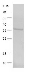    RTCD1 / Recombinant Human RTCD1