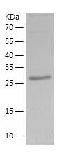    Synaptotagmin V / Recombinant Human Synaptotagmin V