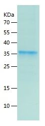    KRIT1 / Recombinant Human KRIT1