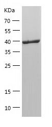 Recombinant Mouse Ogg1