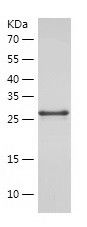    Superoxide Dismutase 4 / Recombinant Human Superoxide Dismutase 4