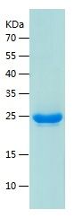    CHD2 / Recombinant Human CHD2