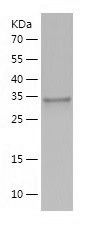    Torsin A / Recombinant Human Torsin A