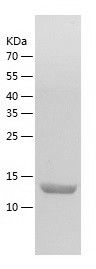    PDCD5 / Recombinant Human PDCD5