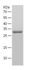    GIPC1 / Recombinant Human GIPC1