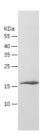    MYL12B / Recombinant Human MYL12B