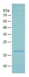    LECT2 / Recombinant Human LECT2