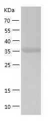    MAPK 13 / Recombinant Human MAPK 13