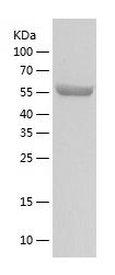    PPM1G / Recombinant Human PPM1G