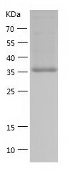    BCAT2 / Recombinant Human BCAT2