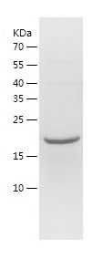    RGS16 / Recombinant Human RGS16