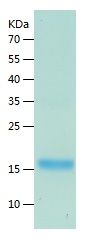    sPLA2-X / Recombinant Human sPLA2-X