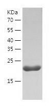    FGF10 / Recombinant Human FGF10