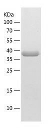    Ogg1 / Recombinant Human Ogg1