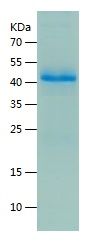    RS1 / Recombinant Human RS1