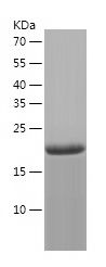    RGS5 / Recombinant Human RGS5