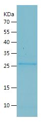 Recombinant Rat Cathepsin K