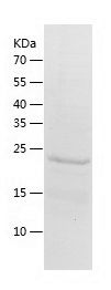 Recombinant Mouse SOCS1