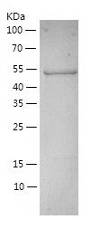    HCM / Recombinant Human HCM