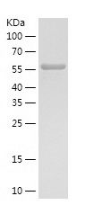    PHGDH / Recombinant Human PHGDH