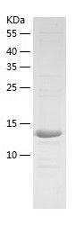    ZNHIT1 / Recombinant Human ZNHIT1