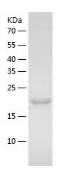    Dhh / Recombinant Human Dhh