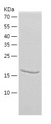    AIMP3 / Recombinant Human AIMP3