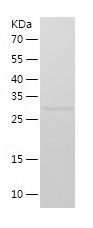    KMT1A / Recombinant Human KMT1A