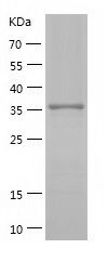    AKR7A2 / Recombinant Human AKR7A2