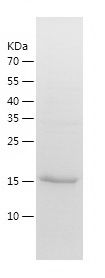    HBXIP / Recombinant Human HBXIP